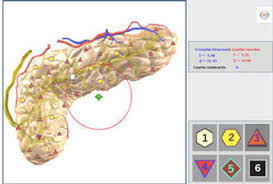 biorésonance biospect analyse fréquence